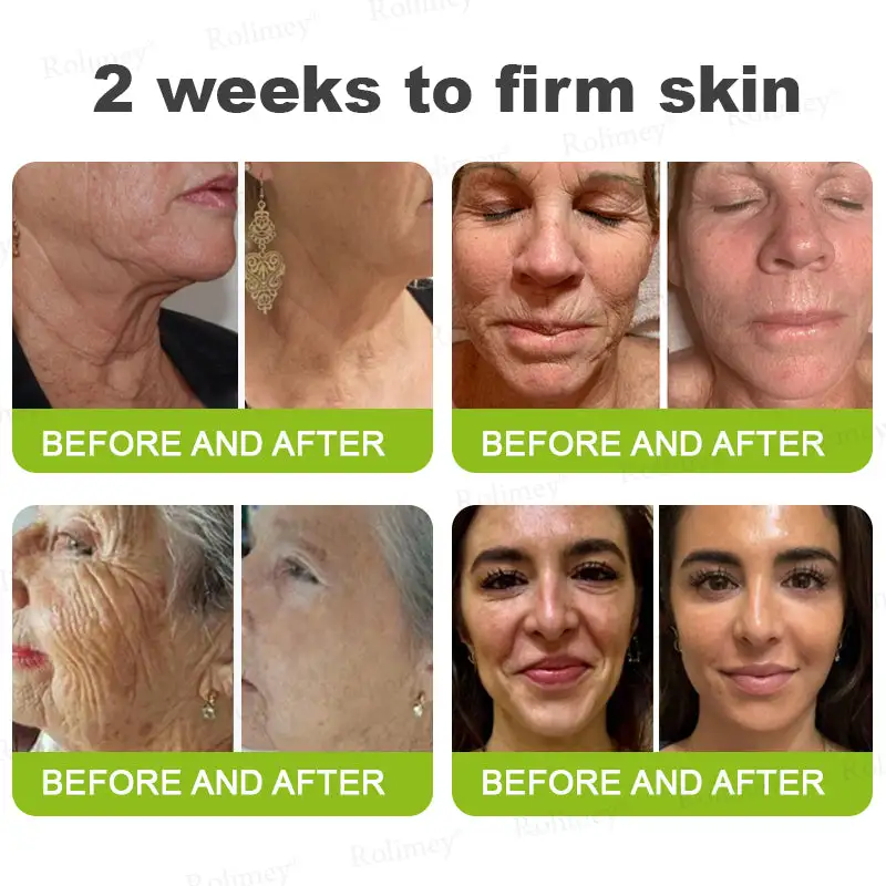 Botox & Vita-A Retinol Shot Wrinkle-Lift Tightening stick - Image 8