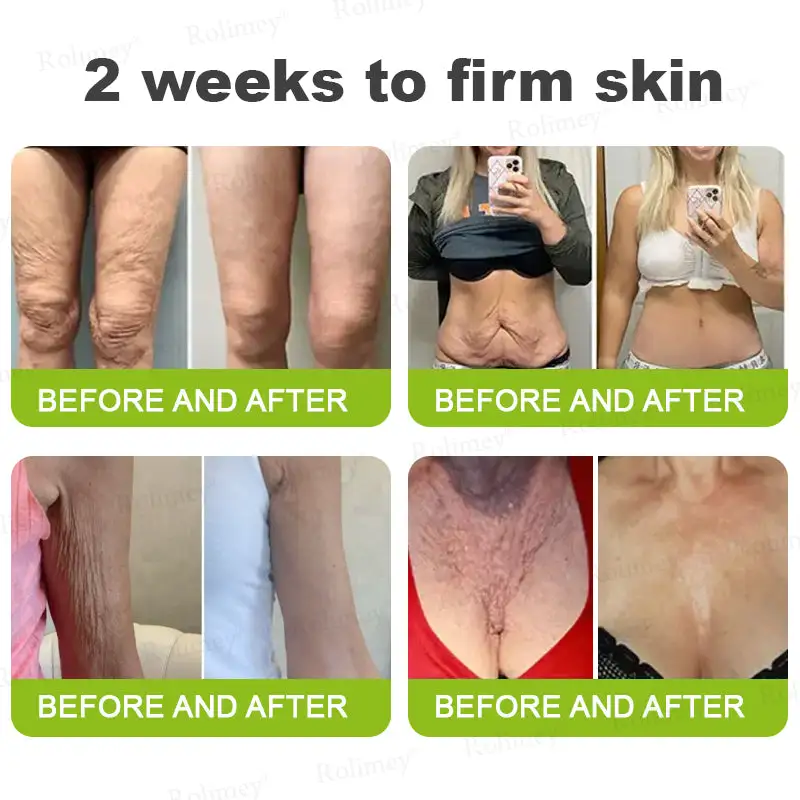 Botox & Vita-A Retinol Shot Wrinkle-Lift Tightening stick - Image 9