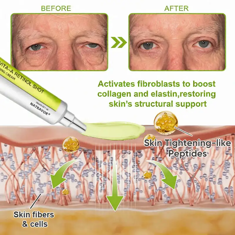Botox & Vita-A Retinol Shot Wrinkle-Lift Tightening cream - Image 22
