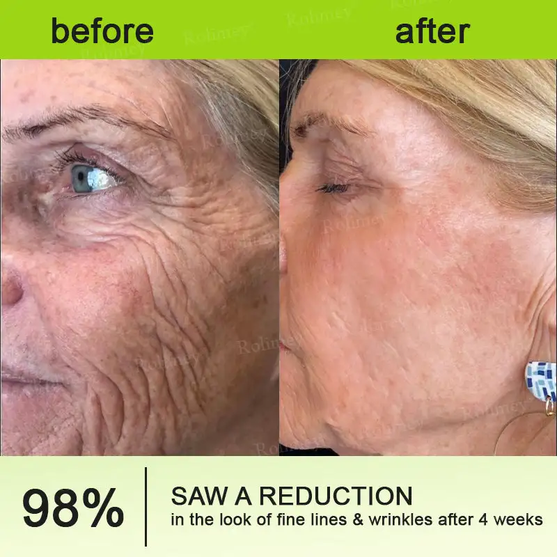 Botox & Vita-A Retinol Shot Wrinkle-Lift Tightening cream - Image 7