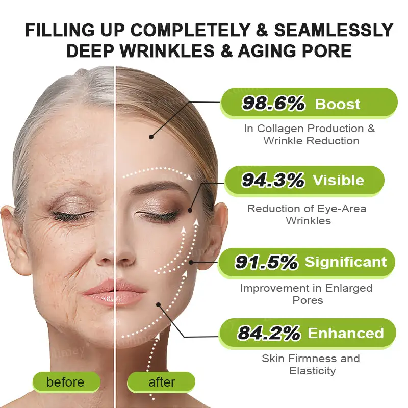 Botox & Vita-A Retinol Shot Wrinkle-Lift Tightening cream - Image 8