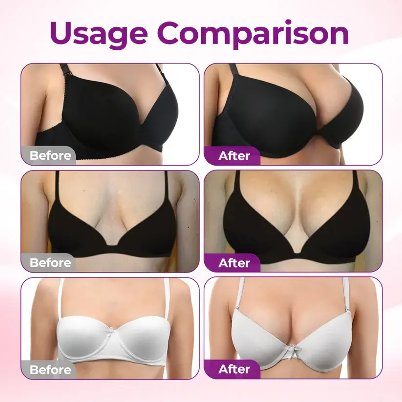 Targeted Breast Enhancement Advanced Nano Microneedle Patch - Image 3