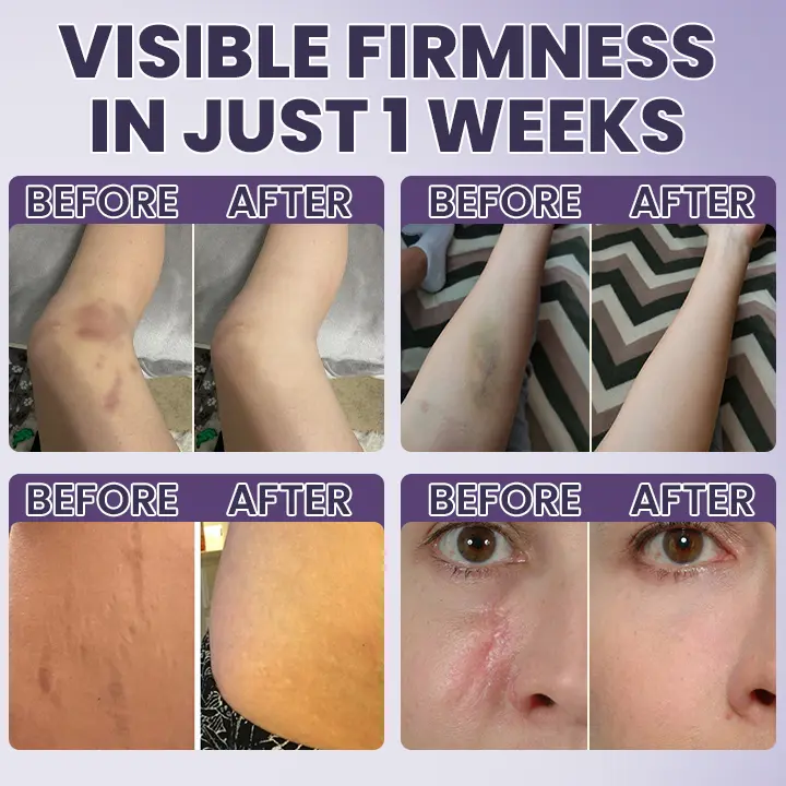 Bruise Recovery Cream - Image 10