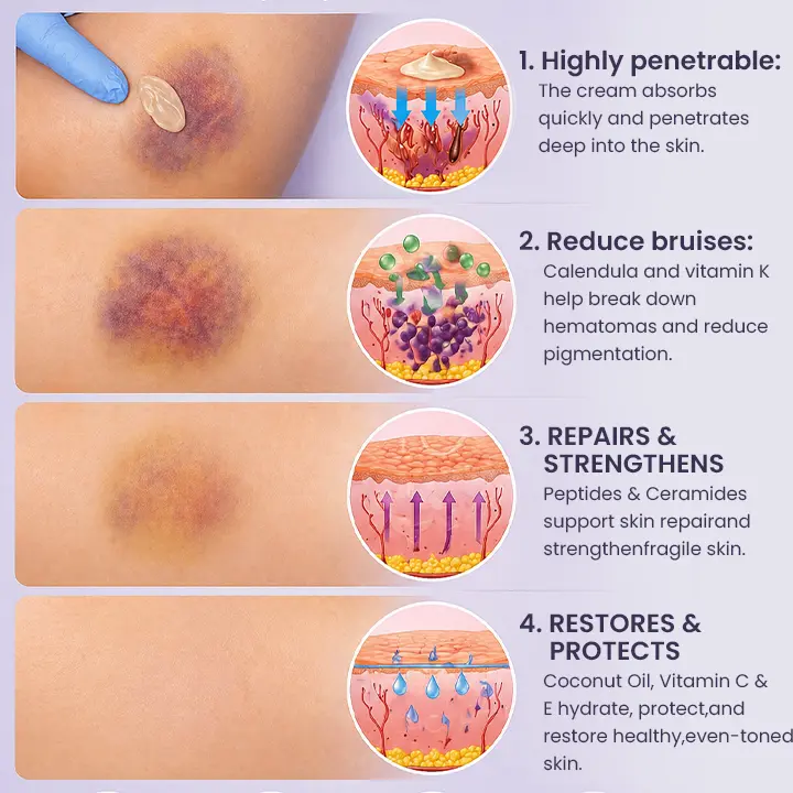 Bruise Recovery Cream - Image 12