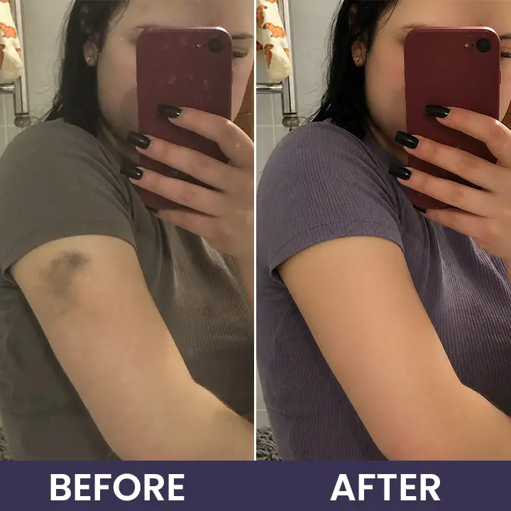 Bruise Recovery Cream - Image 13