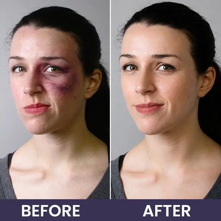 Bruise Recovery Cream - Image 15