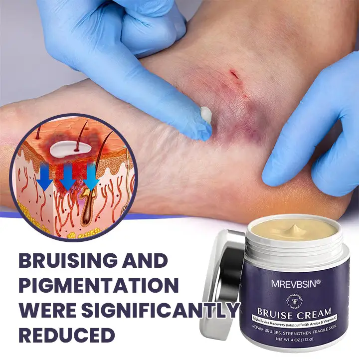 Bruise Recovery Cream - Image 3