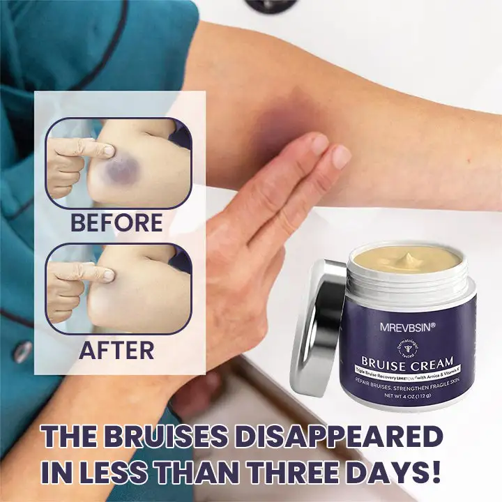 Bruise Recovery Cream - Image 6