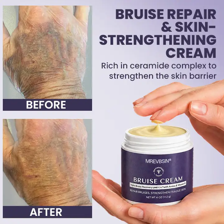 Bruise Recovery Cream - Image 8