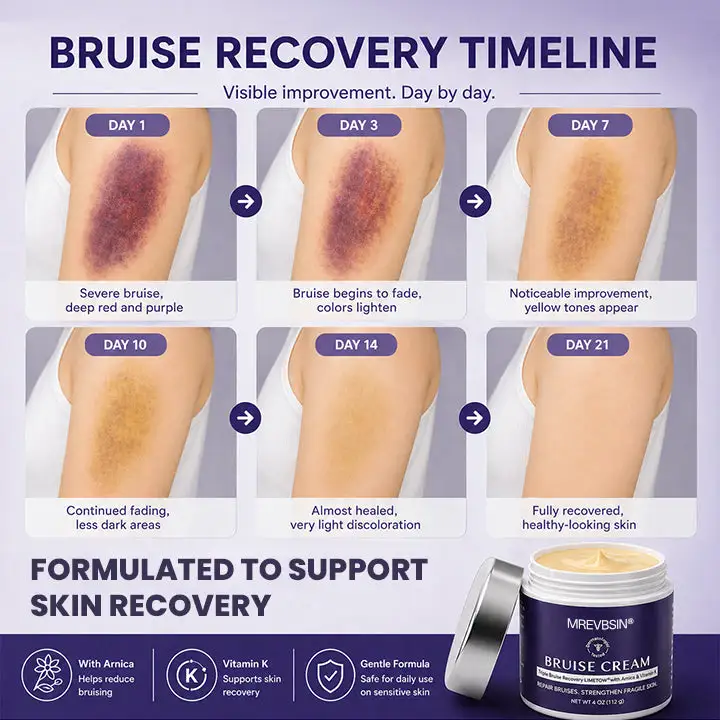 Bruise Recovery Cream - Image 9