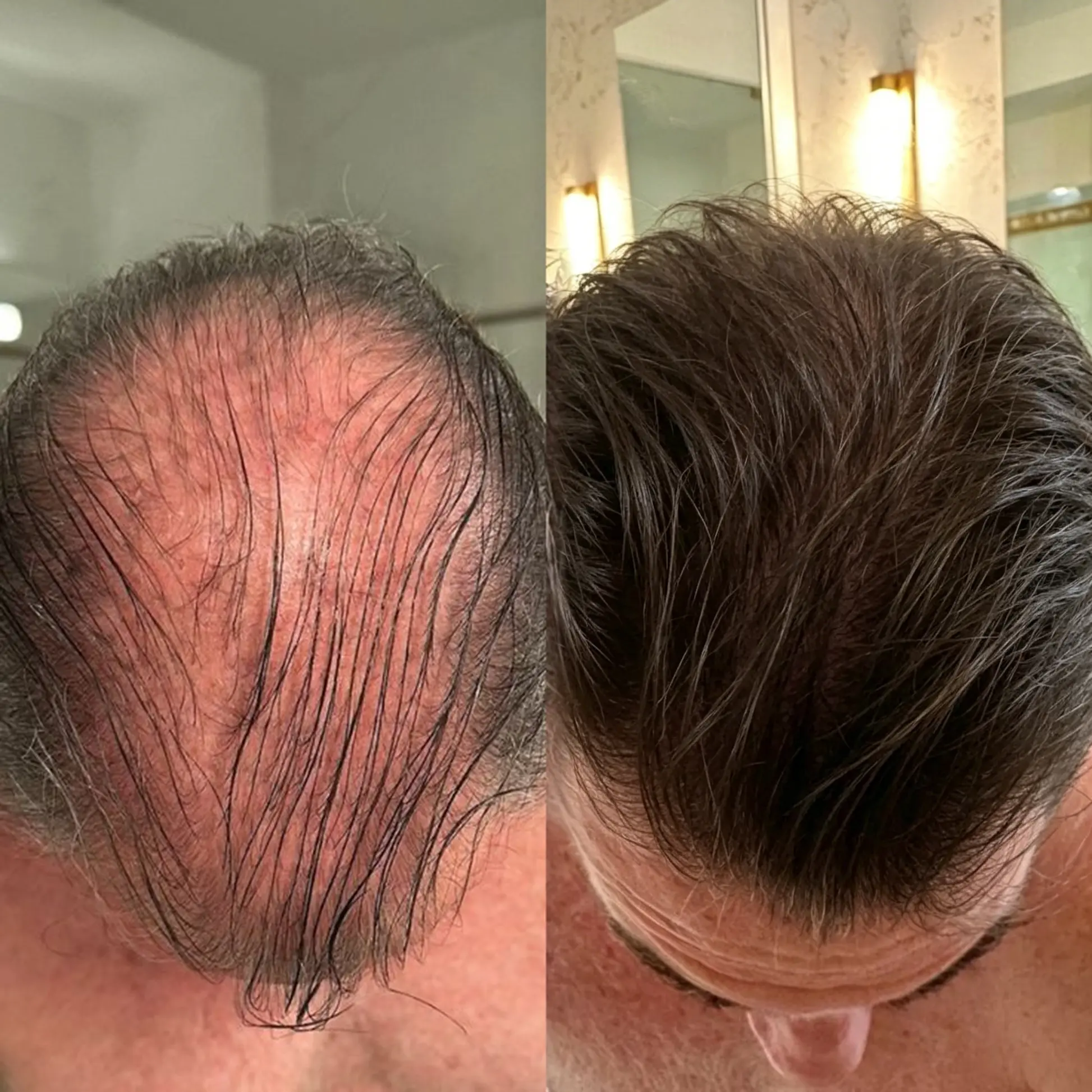 2-in-1 Onion & Rosemary Shampoo + Conditioner - Image 4