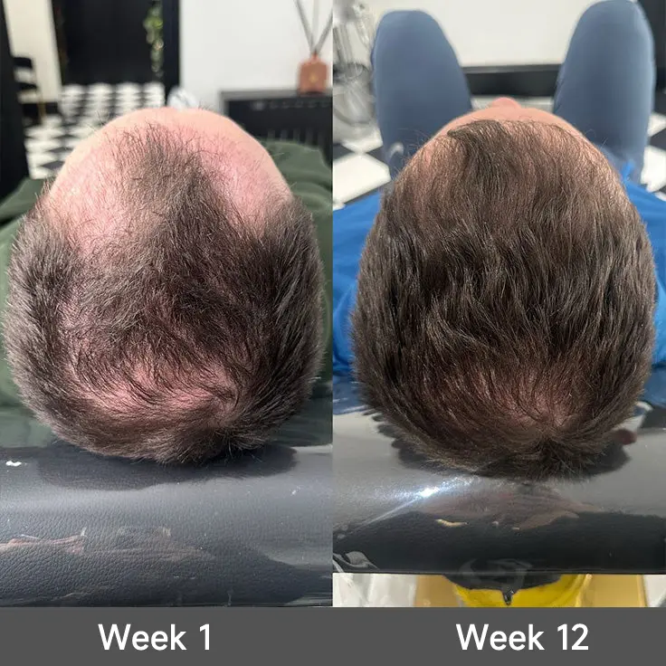 2-in-1 Onion & Rosemary Shampoo + Conditioner - Image 7