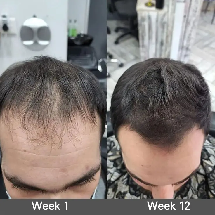 2-in-1 Onion & Rosemary Shampoo + Conditioner - Image 8