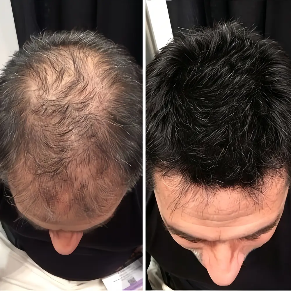 2-in-1 Onion & Rosemary Shampoo + Conditioner - Image 9