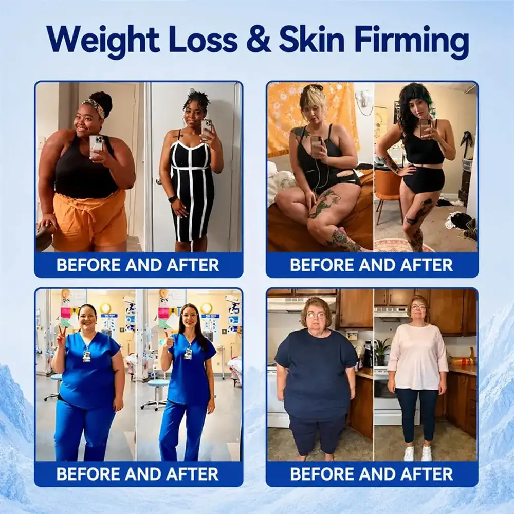 4-in-1 Cryo Sculpt Mist - Image 2
