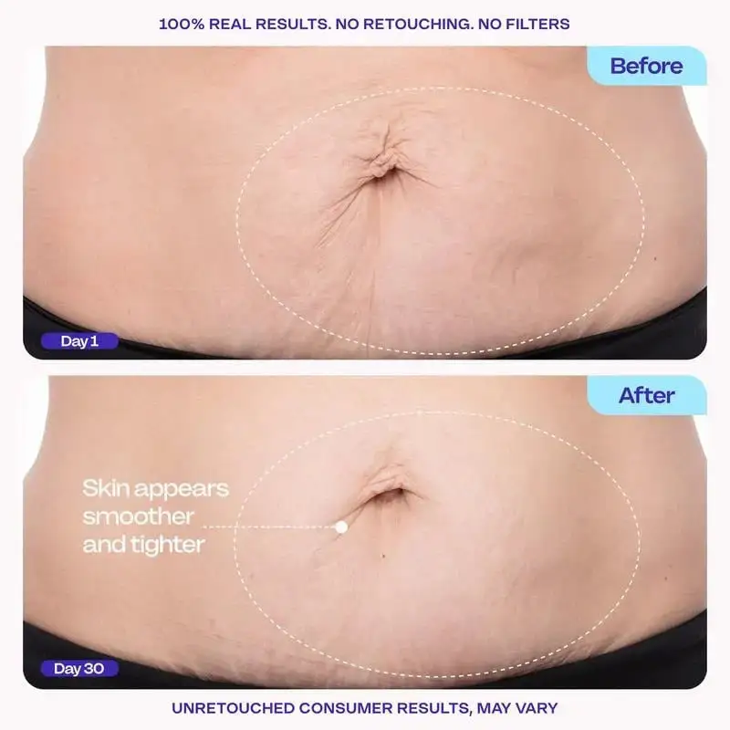 QIAWI TIGHTEN & SMOOTH BELLY FIRMING CREAM - Image 8