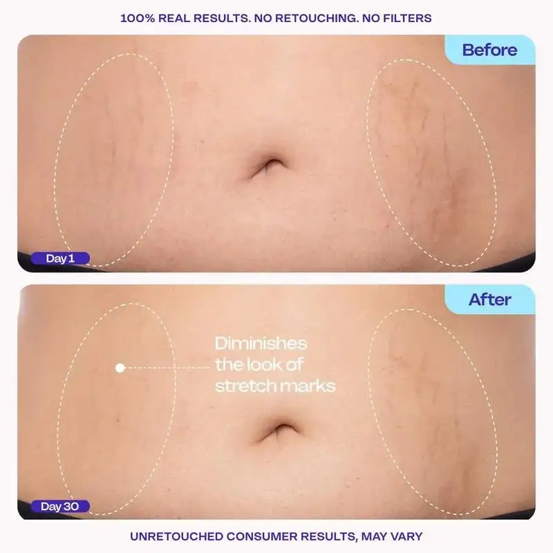 QIAWI TIGHTEN & SMOOTH BELLY FIRMING CREAM - Image 9