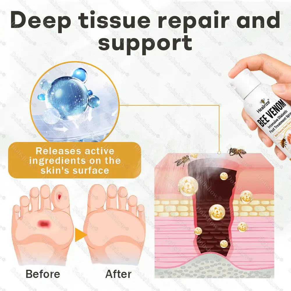 Bee Venom Intensive Diabetic Foot Treatment Spray - Image 4