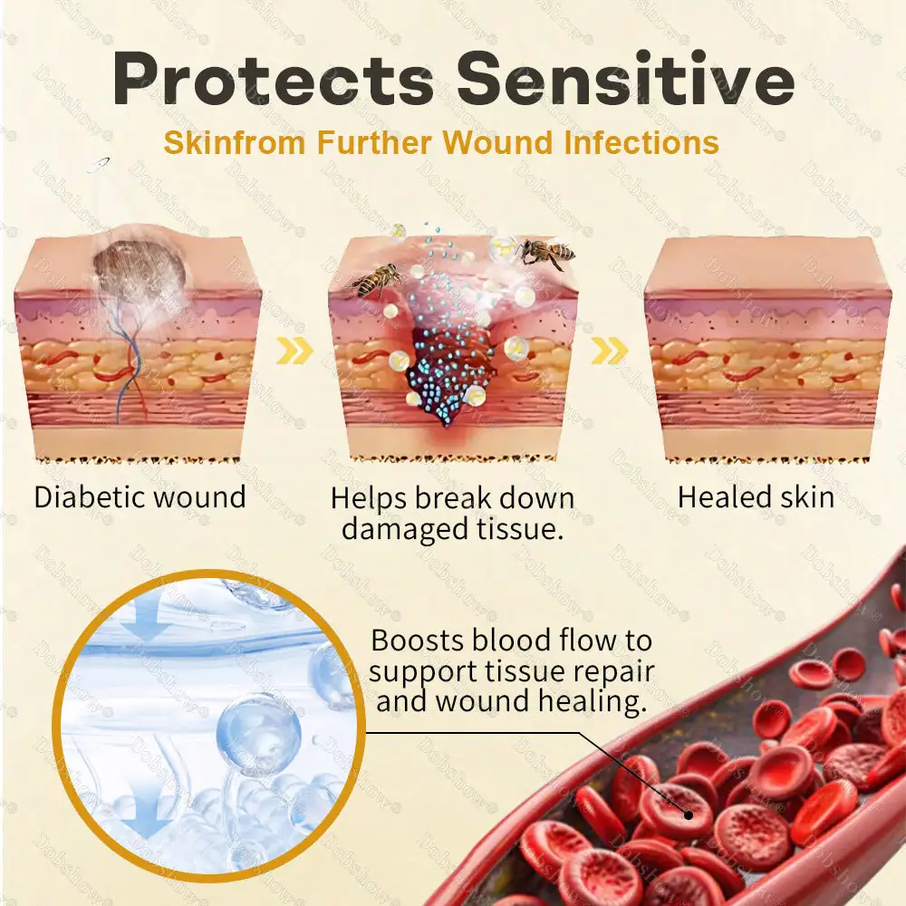 Bee Venom Intensive Diabetic Foot Treatment Spray - Image 5