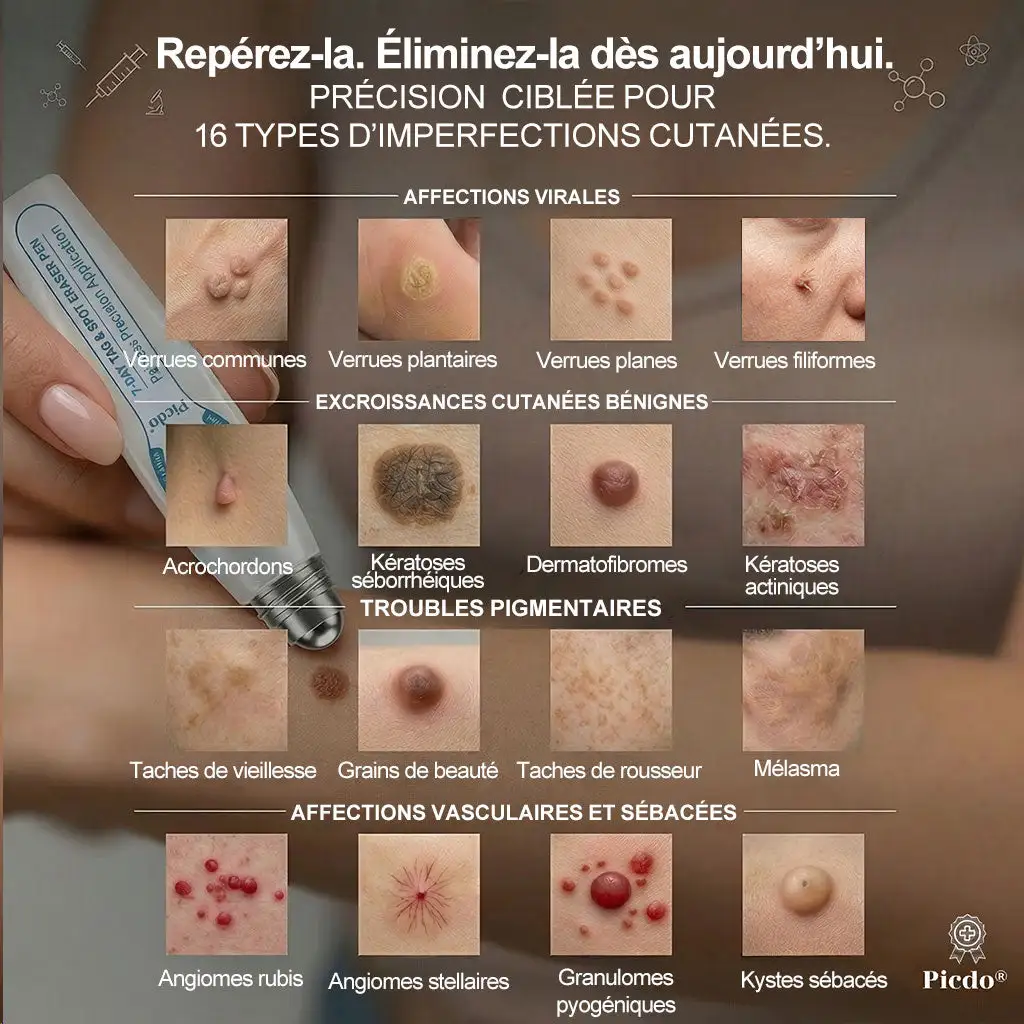Éliminateur d'Excroissances Cutanées & de Taches en 7 Jours Sans Douleur & Sans Cicatrice - Image 5