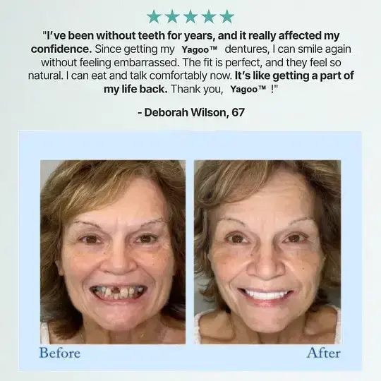 Advanced Customized Full Denture Set - Image 13