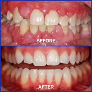 Alternative view of VioCore Bee Venom Dental Treatment Toothpaste