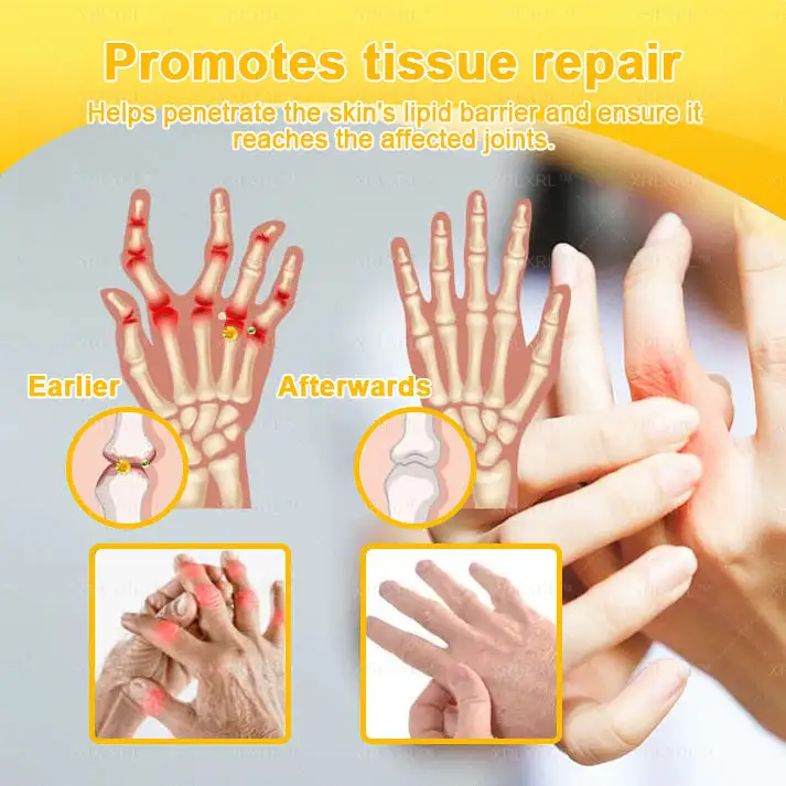 Bee Venom Pain-Relief Bone Healing Cream - Image 10