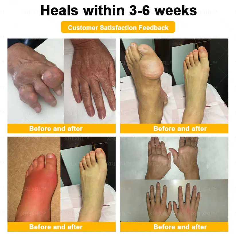 Bee Venom Pain-Relief Bone Healing Cream - Image 3