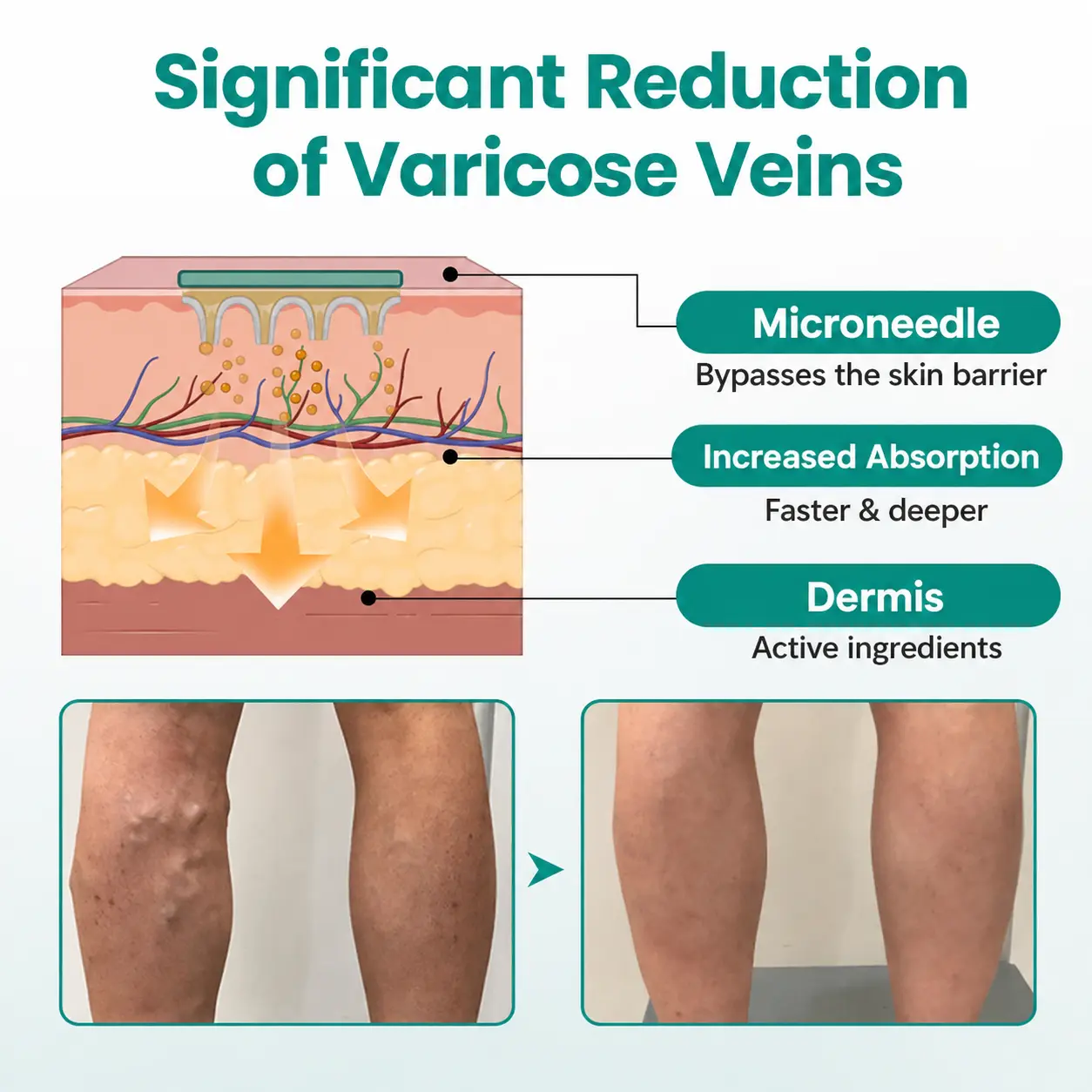 LegRenew Varicose Vein Patch - Image 2