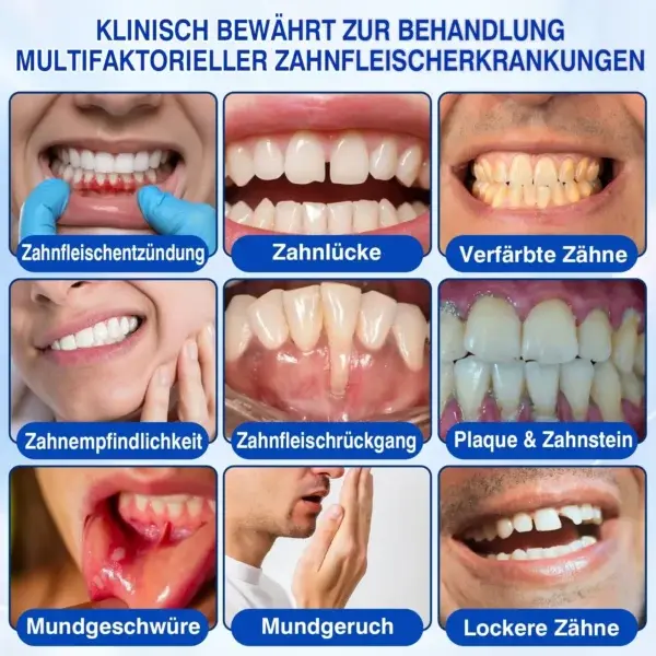 GumRevive Parodontales Reparaturgel - Image 11