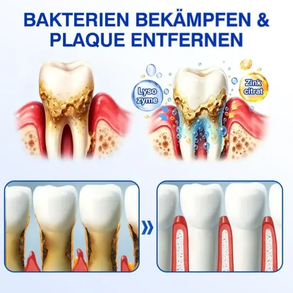 GumRevive Parodontales Reparaturgel - Image 6