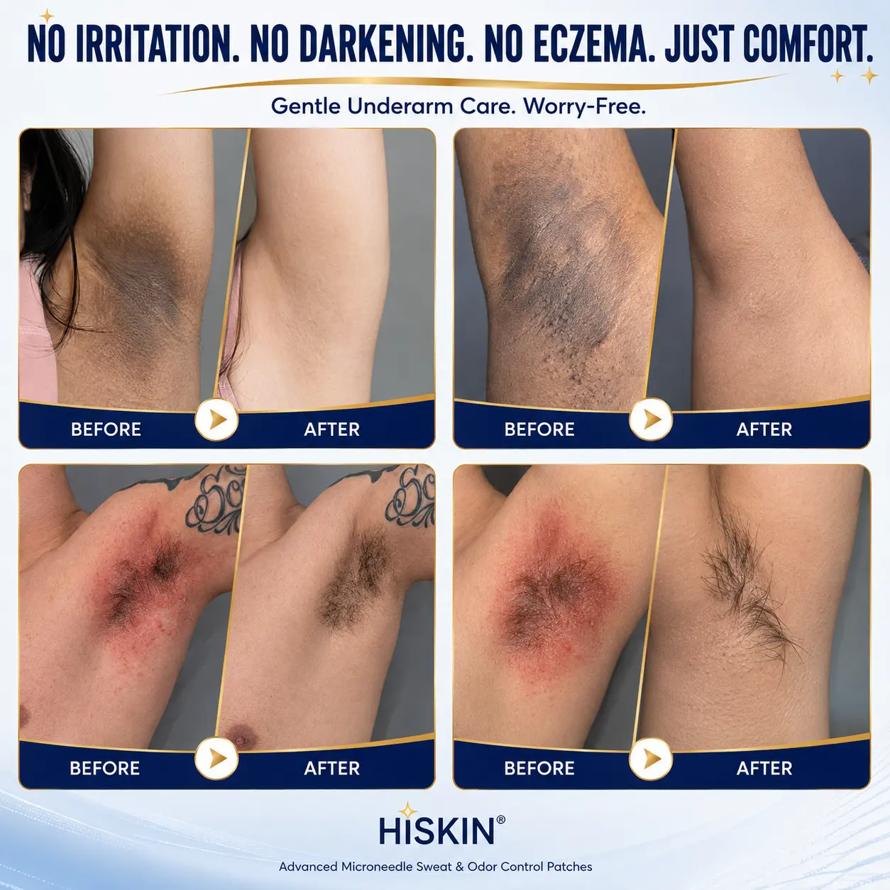 2-in-1 Advanced Sweat Control & Deodorant Microneedle Patches - Image 3