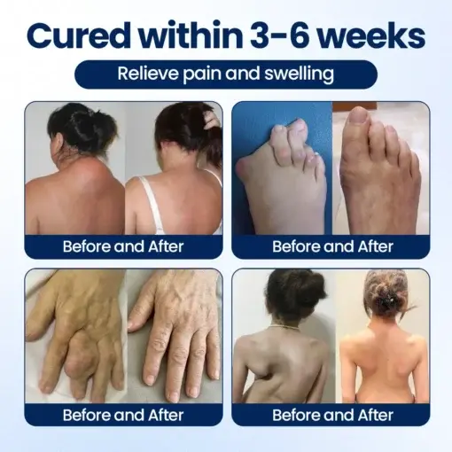 ArthriNAD+ Pro Advanced Joint Recovery Cream - Image 8
