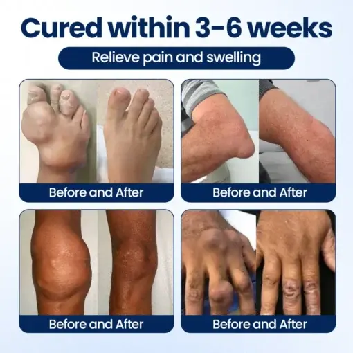 ArthriNAD+ Pro Advanced Joint Recovery Cream - Image 9