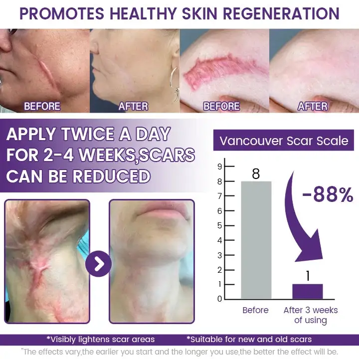 Grunsify Scar Repair Gel - Image 2