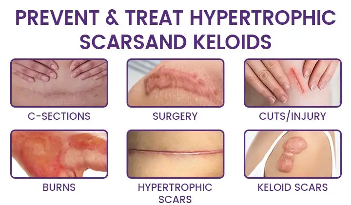 Grunsify Scar Repair Gel - Image 3