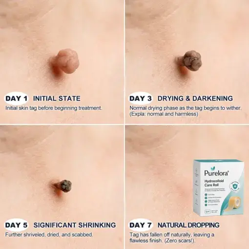 6-in-1 Hydrocolloid Patch - Image 9