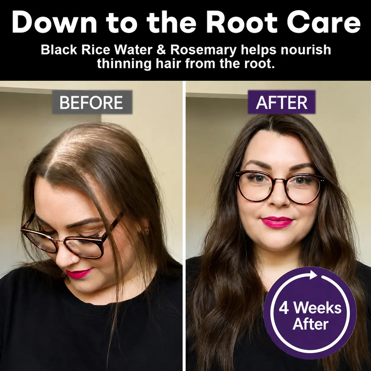Black Rice & Red Onion Hair Growth Spray - Image 2
