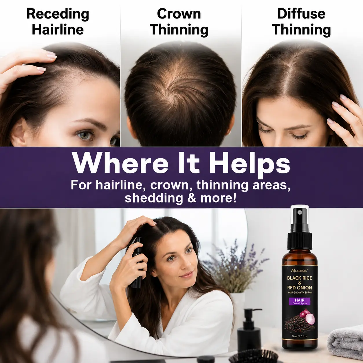 Black Rice & Red Onion Hair Growth Spray - Image 3