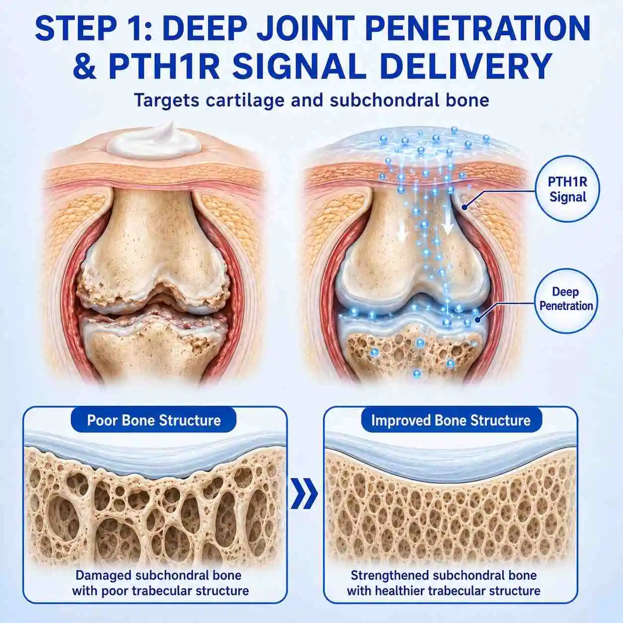 PTH1R Arthritis Joint Cream - Image 5