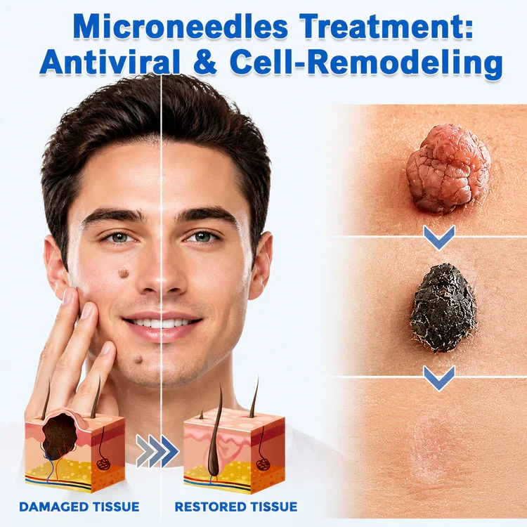 Microneedle Clear Patches - Image 2