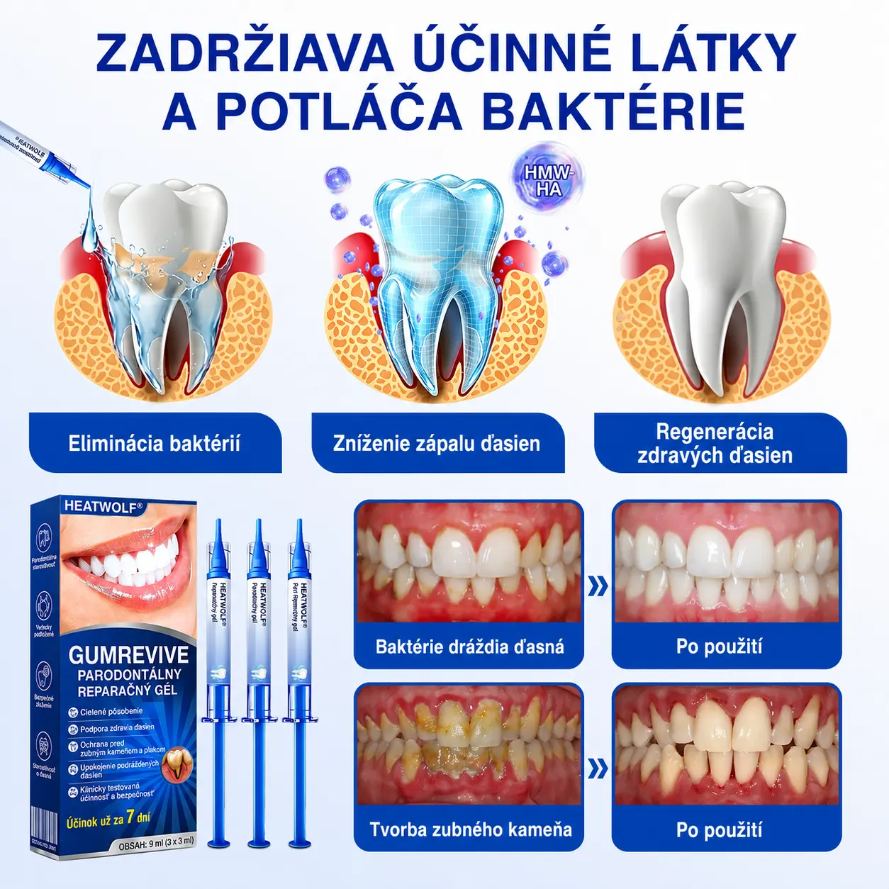 GumRevive Parodontálny opravný gél - Image 9