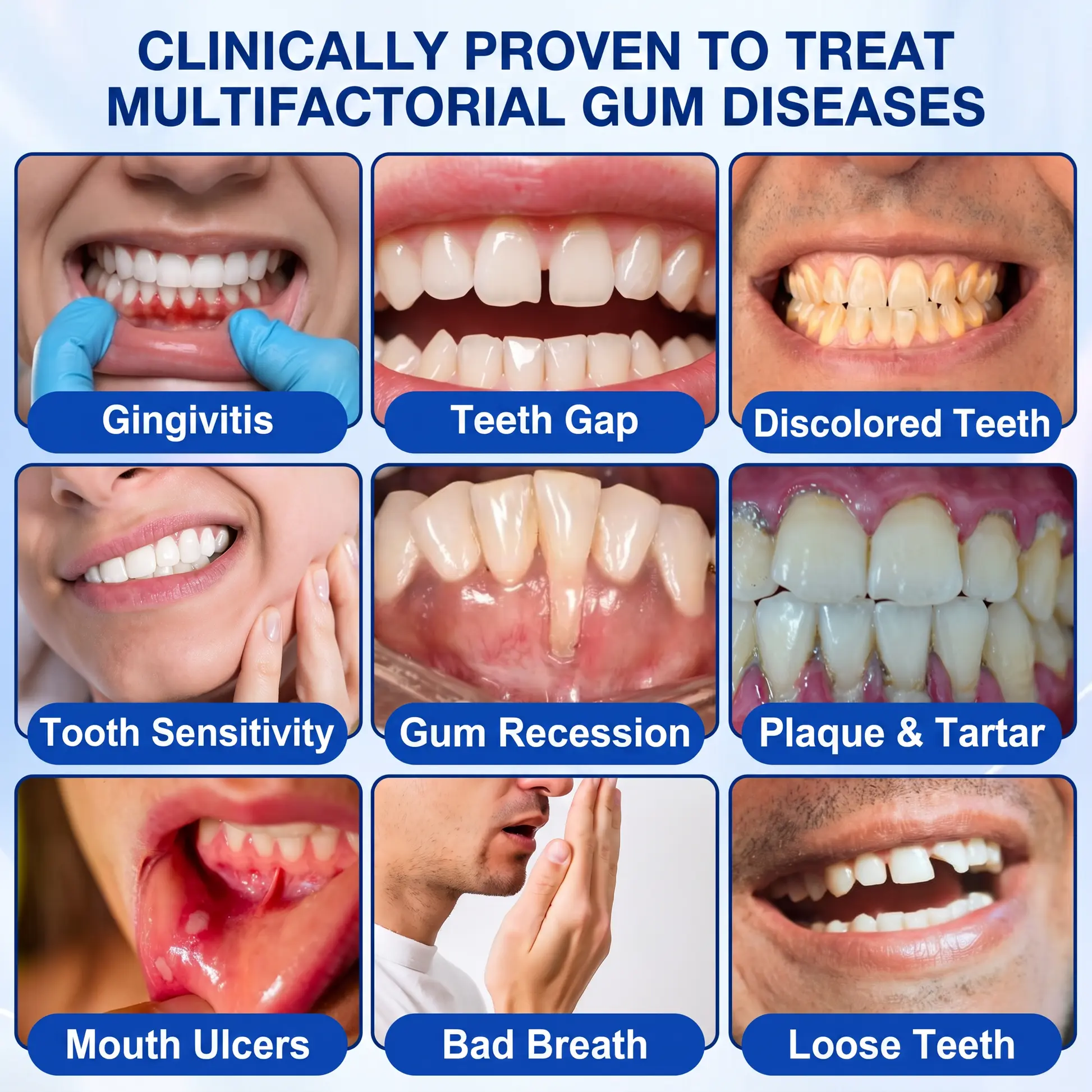Periodontal Repair Gel - Image 5